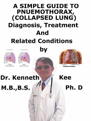 cover image of A Simple Guide to Pneumothorax (Collapsed Lungs), Diagnosis, Treatment and Related Conditions